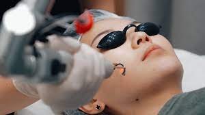 Picosure & Q-Switch Laser